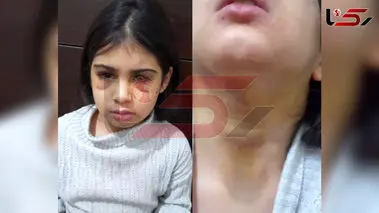 فیلم/ تصاویر دلخراش از کودک‌آزاری یک دختربچه سنندجی
