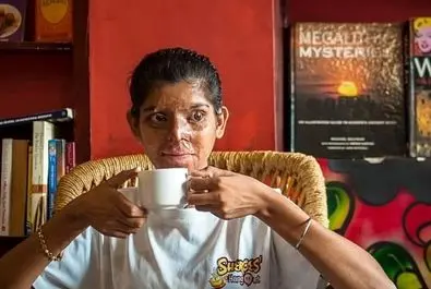 کافه قربانیان اسیدپاشی