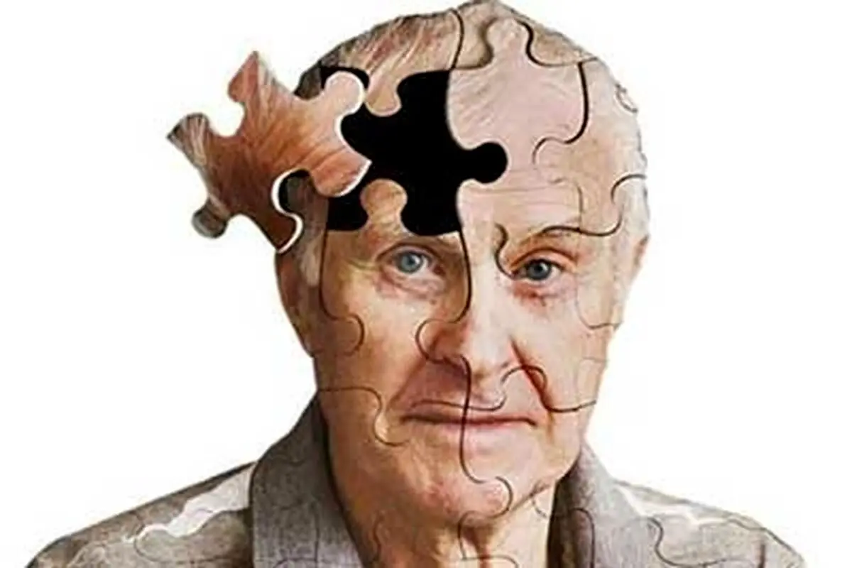 چگونه از ابتلا به آلزایمر جلوگیری کنیم؟
