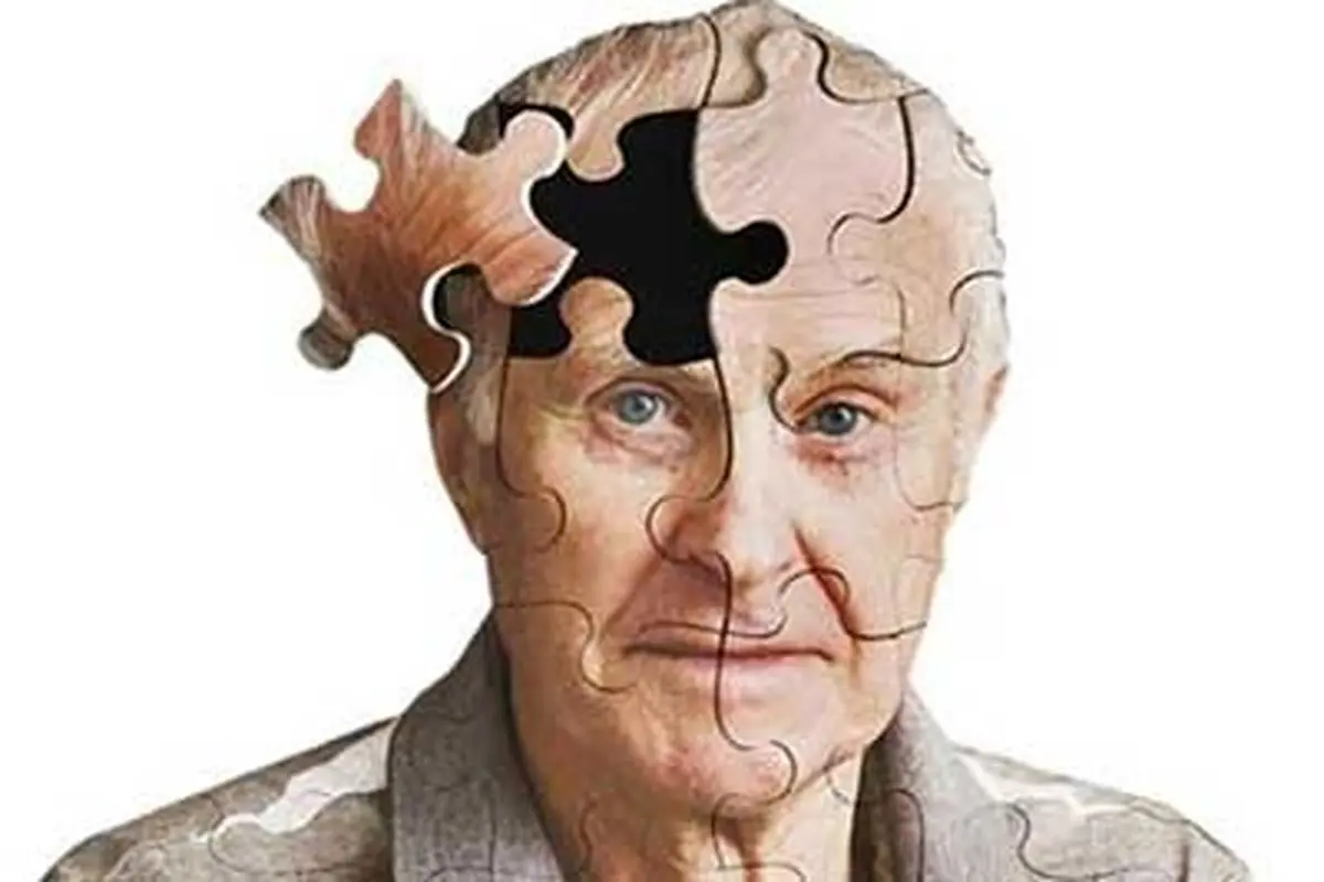 چگونه از ابتلا به آلزایمر جلوگیری کنیم؟
