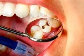 هر ایرانی چند درد خراب دارد؟ +فیلم