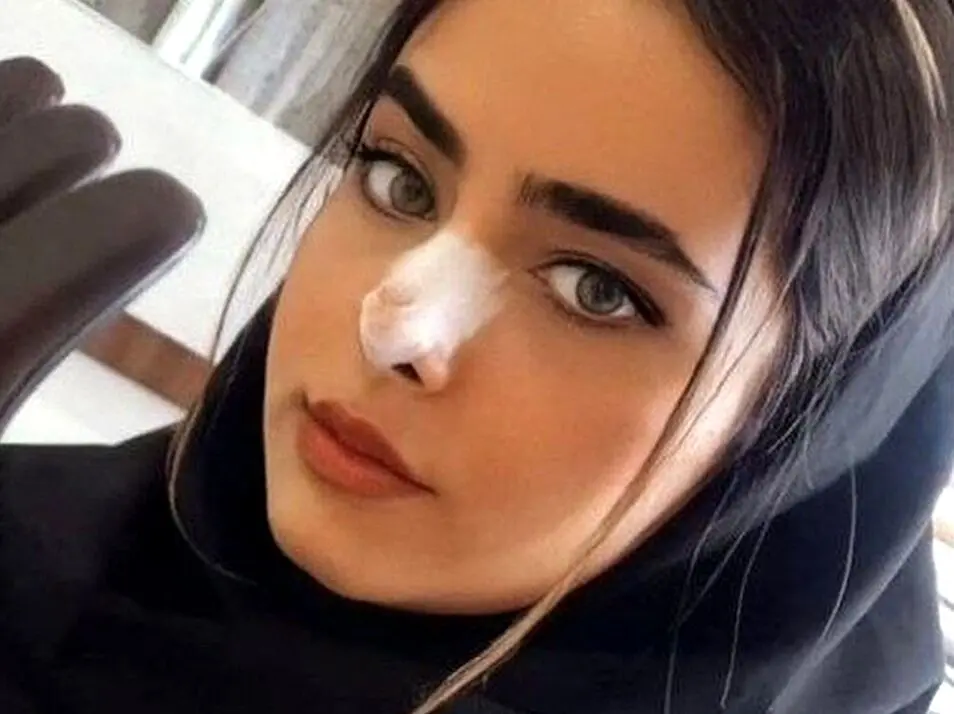روایت‌های متناقض درباره مرگ مشکوک «آیلار حقی»