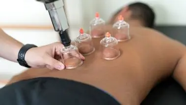 تقویم حجامت : بهترین روزها برای حجامت در پاییز