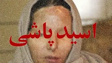 اسیدپاشی روی صورت خانم معاون در مدرسه