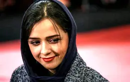  بیماری ترانه علیدوستی چیست ؟چرا دست‌های ترانه علیدوستی پیرشده است