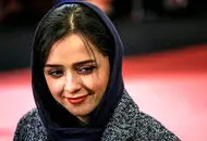  بیماری ترانه علیدوستی چیست ؟چرا دست‌های ترانه علیدوستی پیرشده است