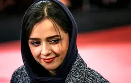  بیماری ترانه علیدوستی چیست ؟چرا دست‌های ترانه علیدوستی پیرشده است