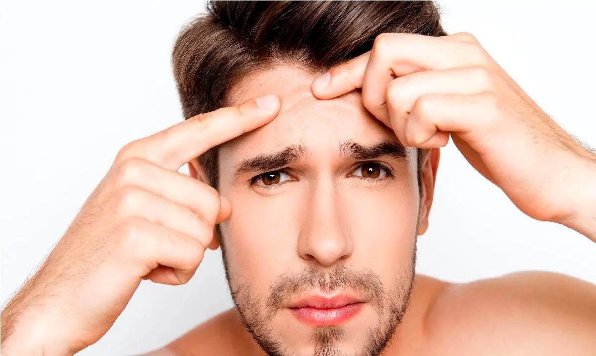 ترفندهای عالی برای از بین بردن جوش های صورت