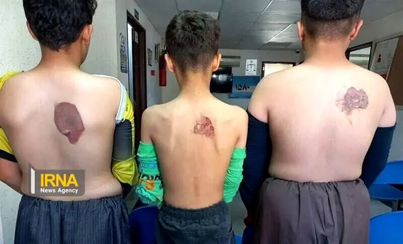 جزئیات وحشتناک از خیاطی که شاگردانش را با اتو داغ کرد

