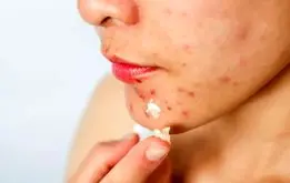 این دمنوش برای سلامت پوست معجزه می‌کند
