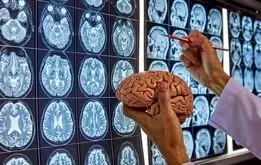 جراحی مغز و اعصاب؛ لیست بهترین متخصصان جراحی مغز و اعصاب

