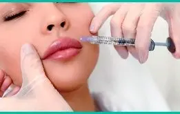 نحوه تزریق ژل لب مدل روسی چگونه است؟

