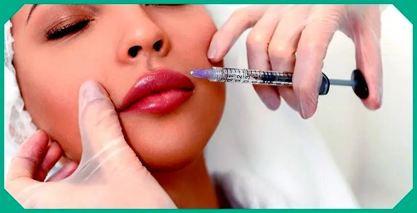 نحوه تزریق ژل لب مدل روسی چگونه است؟

