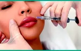 نحوه تزریق ژل لب مدل روسی چگونه است؟

