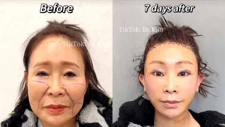 تصویری بحث برانگیز از جراحی پلاستیک + عکس
