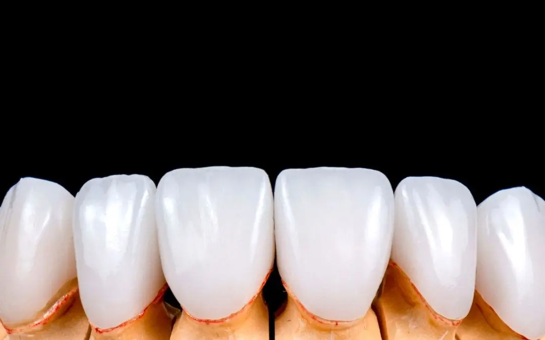 هزینه خدمات دندانپزشکی و دلایل گران بودن آن چیست؟

